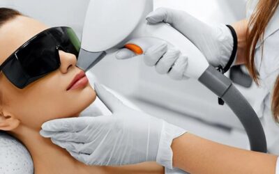 Falsos mitos de la depilación laser en la cara