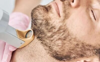 Depilación láser de barba: La guía completa
