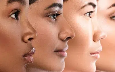 Qué es la melanina y cómo afecta a la depilación láser